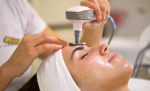 1 o 2 sesiones de radiofrecuencia Indiba facial reafirmante