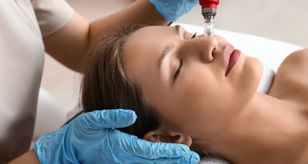 1 o 2 sesiones de exosomas con dermapen para 1 persona, con hasta un 63% de descuento