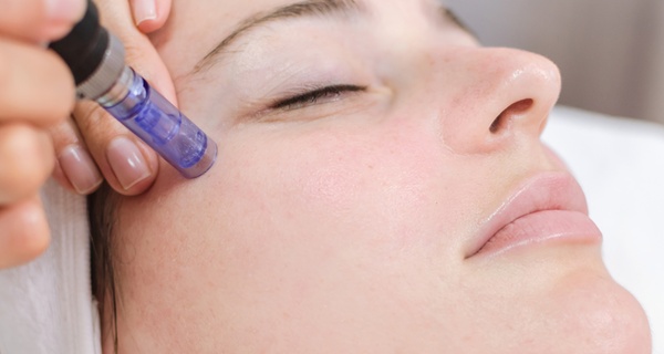 Tratamiento con exosomas con dermapen en 1 o 3 zonas a elegir con hasta un 86% de descuento para 1 persona