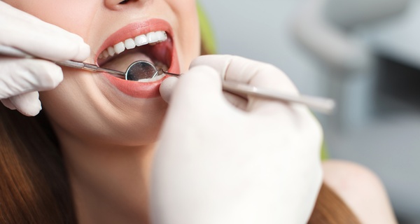 Sesiones de blanqueamiento LED con limpieza bucal y fluorización