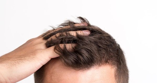 Tratamiento capilar con bioestimulación o mesoterapia