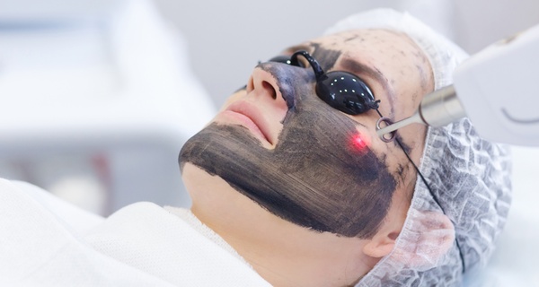 Renueva tu piel con el poder del peeling de carbono activo 4D en Clínica Novastetic Barrio de Salamanca