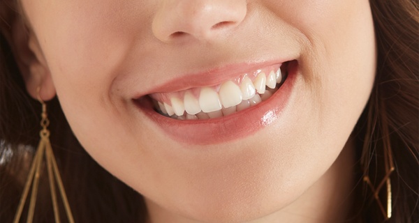 1 o 2 sesiones de blanqueamiento dental led en Clínica Dental Dr Borrega (Clínica en Madrid); ahorra hasta 91%