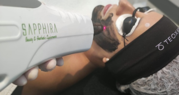 Tratamiento facial con láser con hasta un   86% de descuento en Sapphira Prive Madrid centro
