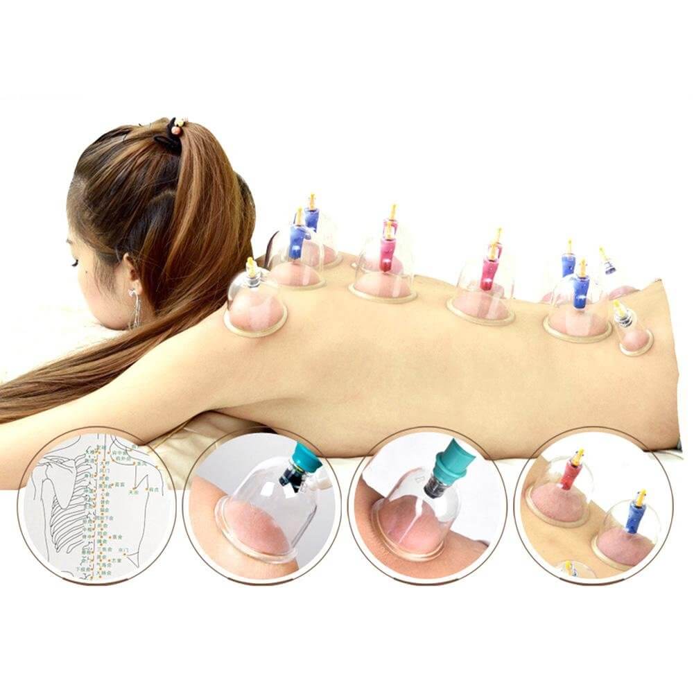 Biomagnetic Vacuum Body Cupping Therapy Set 24 Cups