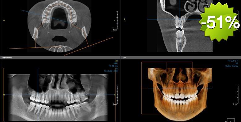 CBCT 3D snimka kompletne gornje i donje čeljusti uz detaljnu analizu snimke, besplatan dentalni pregled dr.med.dent. MSc of Oral implantology i konzultacije