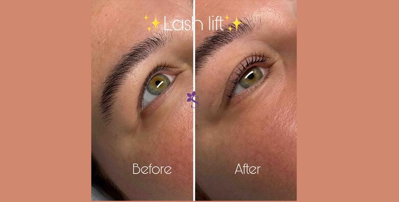 Savršen look uz LASH I BROW LIFT i uključeno bojanje te serum - u samo jednom dolasku osviježite izgled uz bezbolan i jednostavan tretman