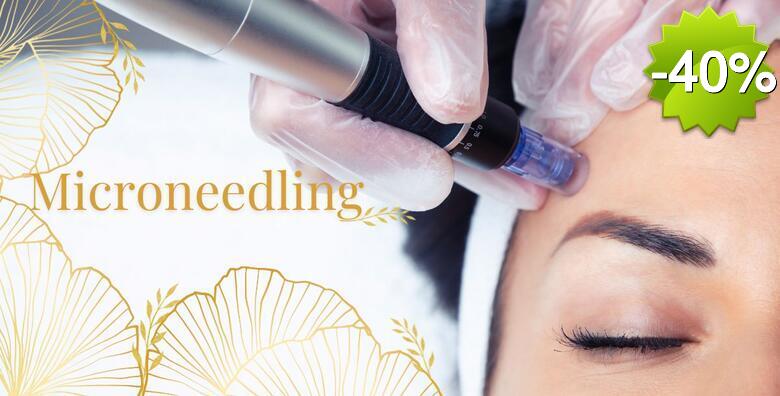 Microneedling - pomladite lice prirodnim putem te aktivirajte proizvodnju kolagena i elastina u Salonu ljepote Green line body