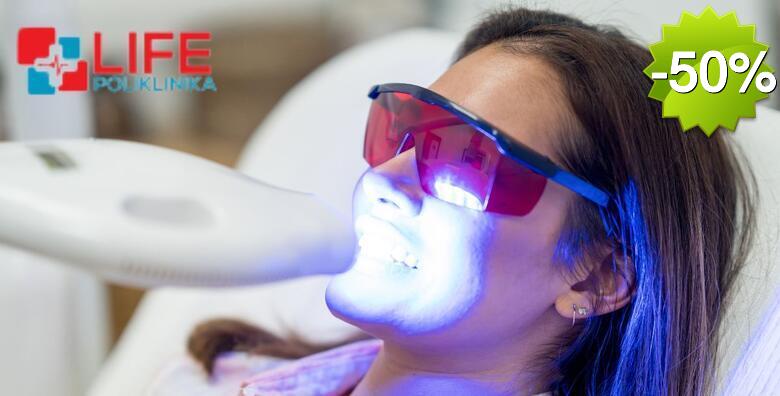 IZBJELJIVANJE ZUBI - izrada udlaga prema individualnim potrebama uz pregled i konzultacije stručnog tima Poliklinike Life i KUĆNI set za izbjeljivanje