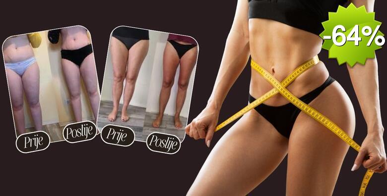 Oblikujte tijelo uz 5 tretmana aparativne limfne drenaže, 5 tretmana Vacuslim 48 i 5 tretmana elektrostimulacije mišića u Glam Lab-u