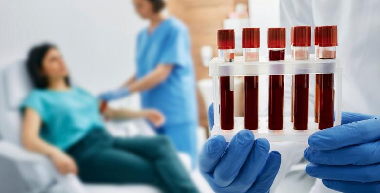 Otkrijte NEDOSTATAK ŽELJEZA ili ANEMIJU na vrijeme i bez čekanja uz sveobuhvatan laboratorijski paket i odmah gotove nalaze u Ustanovi za zdravstvenu skrb Latebra