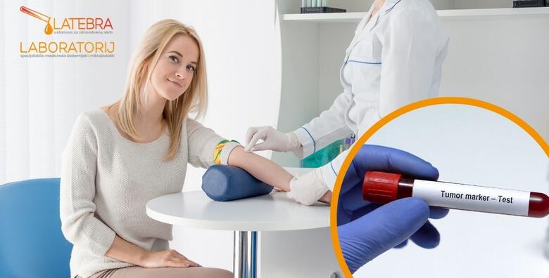 Tumorski markeri za žene - otkrijte problem na vrijeme uz specifične testove koji pomažu u prepoznavanju rizika za nekoliko vrsta raka, uključujući rak jajnika, dojke i debelog crijeva