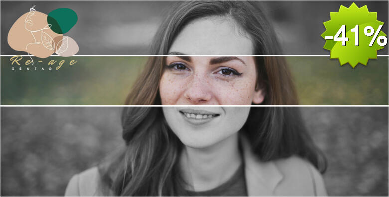 Želite se rješiti tamnih mrlja na svom licu ili rukama ili dekolteu? To više nije problem uz IPL tretman za uklanjanje HIPERPIGMENTACIJE u Re-age Centru