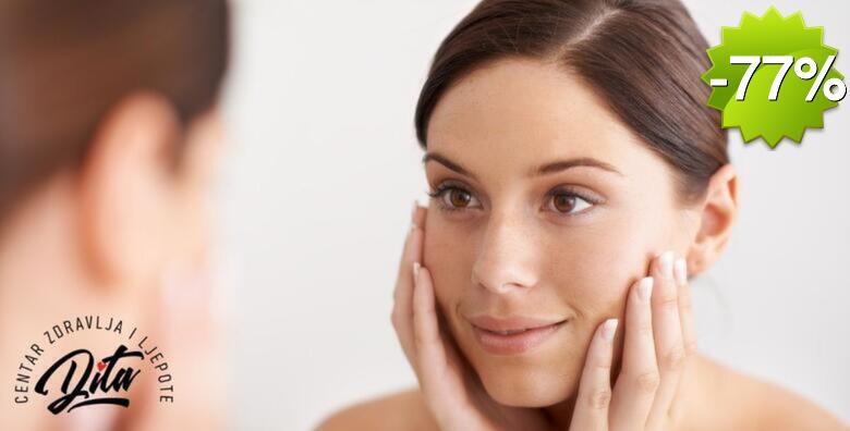 PLASMA PEN - poboljšani izgled bora, nekirurško podizanje kapaka, uklanjanje podočnjaka te poticanje regenerativnih procesa u Centru zdravlja i ljepote Dita