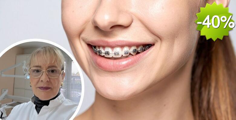 APARATIĆ ZA ZUBE - postavljanje, svi pregledi tijekom nošenja + čišćenje i poliranje zubi kod skidanja aparatića