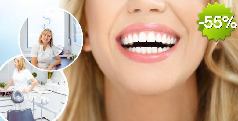 Izbjeljivanje zubi BMS WHITE 38% vodikov peroksid gelom, čišćenje kamenca, pjeskarenje i poliranje zubi u Ordinaciji denrtalne medicine Tijana Župan,dr.med.dent.