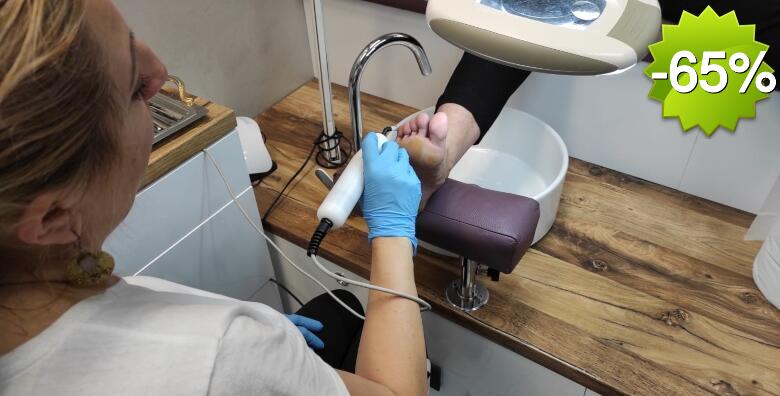 Vratite glatku kožu bez operacija - uklanjanje bradavice s ruke ili noge ozonom uz tretman biolaserom u Studiju ljepote Manuela