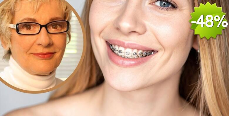 FIKSNI APARATIĆ ZA ZUBE - konvencionalni metalni, uz uključeno postavljanje, sve preglede i konzultacije tijekom terapije