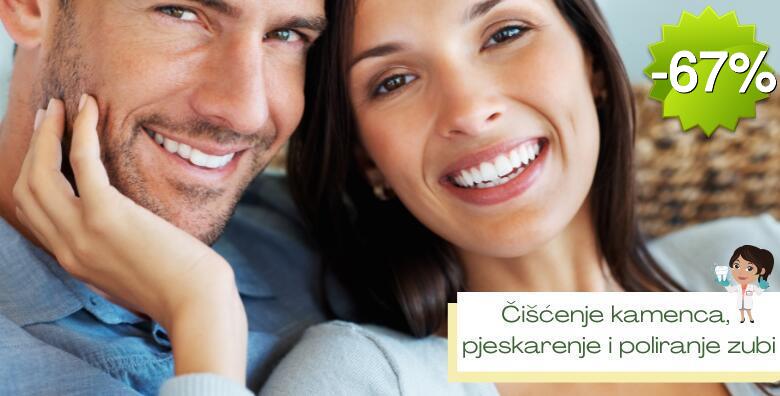 Čišćenje zubnog kamenca, pjeskarenje, poliranje i pregled zubi u Ordinaciji dentalne medicine Kalauz - Devčić