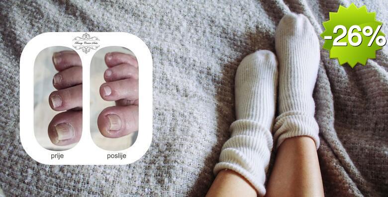 Medicinska pedikura s trajnim lakom - uklanjanje natisaka, kurjih očiju i uraslih noktiju za zdravlje stopala u Beauty centru Salus