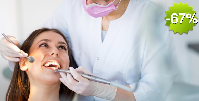 Čišćenje zubnog kamenca s poliranjem i pjeskarenje uz besplatan pregled u Ordinaciji dentalne medicine Maja Parlov