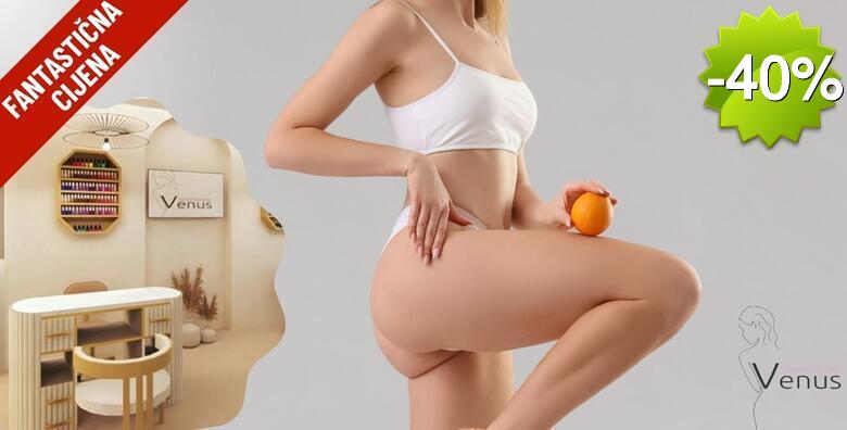Ekskluzivna ponuda koja se ne ponavlja! Anticelulitni tretmani u NOVOOTVORENOM Medicinsko estetskom centru Venus by Lucija Šarić u SESVETAMA po fantastičnoj cijeni