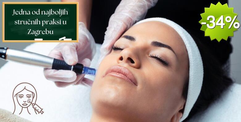Tečaj Dermapen microneedlinga - naučite izvoditi popularan tretman estetske dermatologije i kako riješiti različite kožne probleme u organizaciji Ustanove Dominus