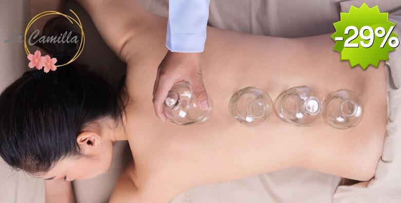 Iskusite moć medicinske masaže leđa i cupping terapije - prirodan put do olakšanja bola, opuštanja mišića i bolje cirkulacije u La Cammila Beauty Baru