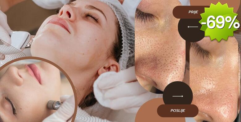 Ultrazvučno čišćenje lica špatulom uz njegu lica pilingom, maskom i masažom te dijamantna mikrodermoabrazija u Glam Lab-u