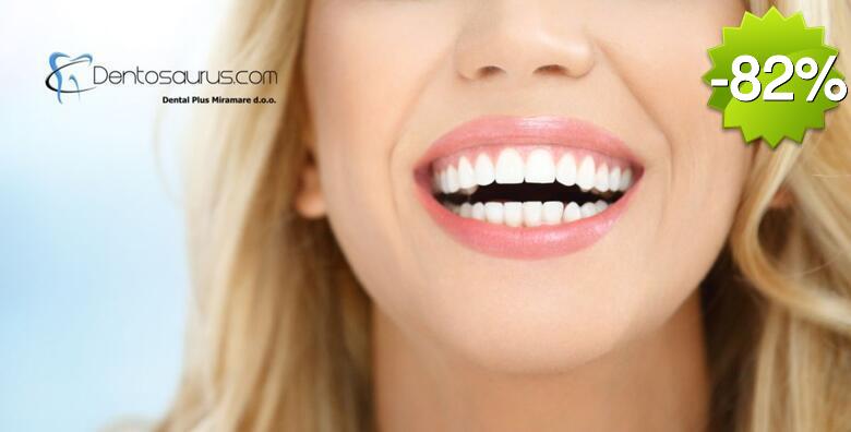 Spriječite karijes i bolesti desni uz čišćenje zubnog kamenca, poliranje, pjeskarenje i pregled u ordinaciji Dental Plus Miramare