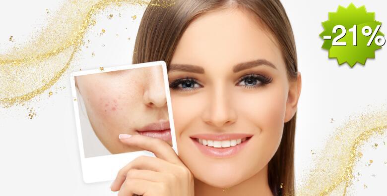 Imate akne, dehidriranu kožu, sitne bore, siv i umoran ten? Izaberite vrhunske tretmane za regeneraciju i obnovu kože lica u Studiju ljepote Manuela