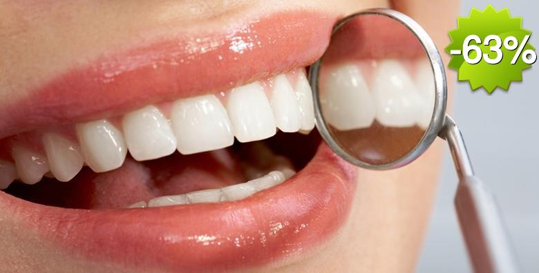 IZBJELJIVANJE ZUBI Opalescence boost tehnologijom - savršen osmjeh uz do 3 nijanse svjetlije zube i trajnost do čak 3 godine