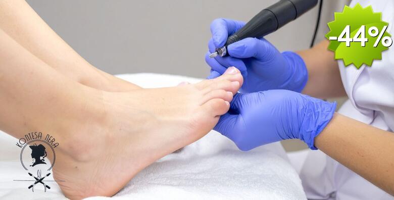 Zaslužena briga za vaša stopala - medicinska pedikura, obrada jednog kurjeg oka i masaža stopla u trajanju 10 minuta u Salonu Kontesa Nera