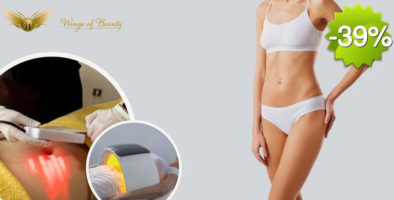 Oblikujte svoje tijelo uz 3 tretmana TERMODEKOM i 3 tretmana SLIMM KUPOLE u kozmetičkom salonu Wings of Beauty