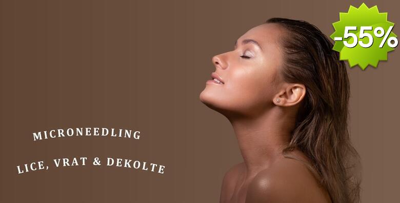 MICRONEEDLING LICA, VRATA I DEKOLTEA - podarite novu mladost vašoj koži uz anti-age tretman visokoučinkovite njege u Jean d`Arcel Medical & Beauty Institutu