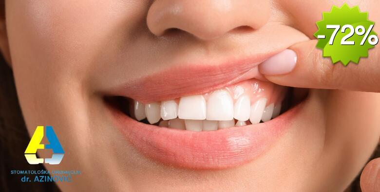 IZBJELJIVANJE ZUBI - laser ili Opalescence boost! Zablistaj ovu jesen uz čak nekoliko nijansi bjelije zube u Stomatološkoj ordinaciji Ivan Azinović, dr.stom.