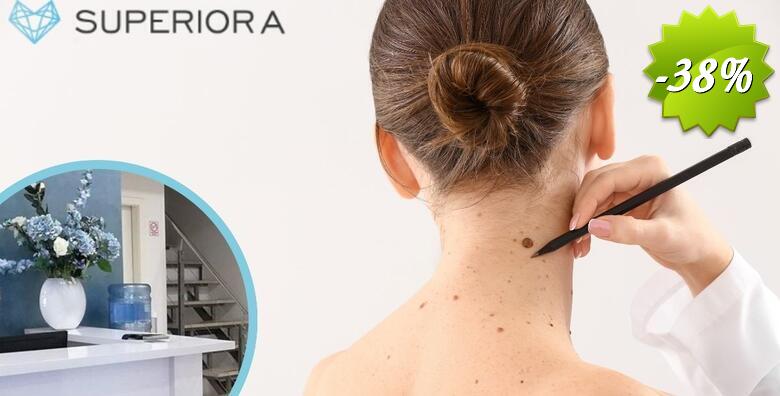 MADEŽI I BRADAVICE - otkrijte moguće zloćudne promjene i uklonite neželjene izrasline uz dermatoskopski pregled i lokalnu anesteziju u Poliklinici Superiora