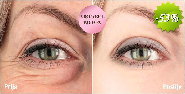 Vistabel 12 jedinica i 0.5 ml svjetski poznatog Restylane filera - najučinkovitijom metodom pomladite vaše oči u Poliklinici Alba Rubra