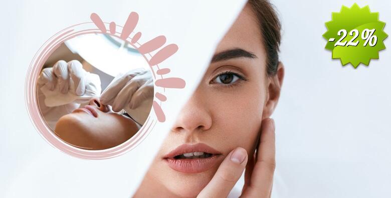 Medicinsko čišćenje lica - kompletan tretman uz piling i visoku frekvenciju te led masku u Kozmetičkom salonu Noa