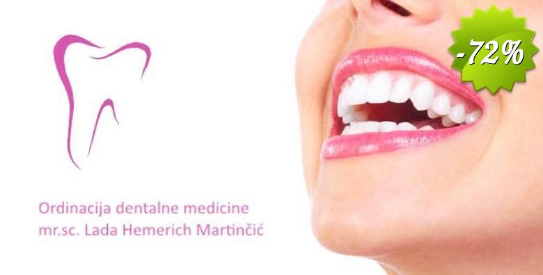 Pregled s konzultacijama, čišćenje zubnog kamenca i pjeskarenje te poliranje i premaz Tooth Mouse pastom u Ordinaciji dentalne medicine Lada Hemerich Martinčić