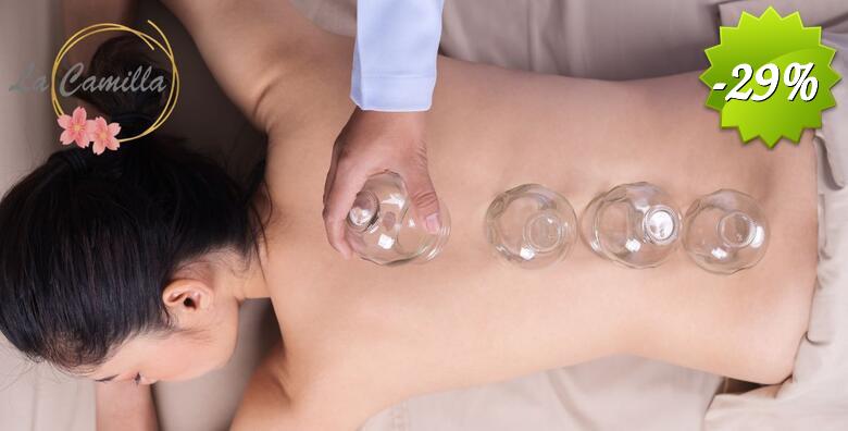 Iskusite moć medicinske masaže leđa i cupping terapije - prirodan put do olakšanja bola, opuštanja mišića i bolje cirkulacije u La Cammila Beauty Baru