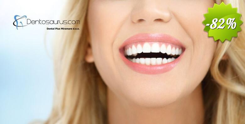 Spriječite karijes i bolesti desni uz čišćenje zubnog kamenca, poliranje, pjeskarenje i pregled u ordinaciji Dental Plus Miramare