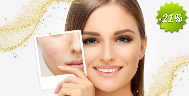 Imate akne, dehidriranu kožu, sitne bore, siv i umoran ten? Izaberite vrhunske tretmane za regeneraciju i obnovu kože lica u Studiju ljepote Manuela