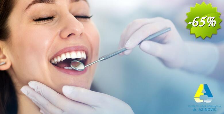Čišćenje zubnog kamenca i pjeskarenje zubi - riješite se naslaga i očuvajte zdravlje zubi u Stomatološkoj ordinaciji Ivan Azinović, dr.stom.