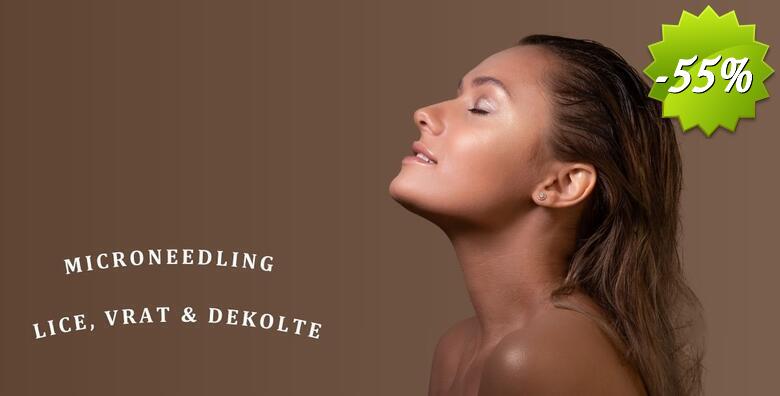 MICRONEEDLING LICA, VRATA I DEKOLTEA - podarite novu mladost vašoj koži uz anti-age tretman visokoučinkovite njege u Jean d`Arcel Medical & Beauty Institutu