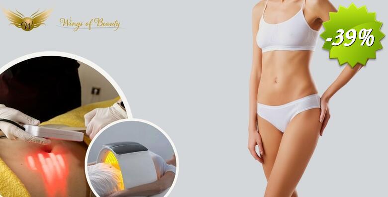 Oblikujte svoje tijelo uz 3 tretmana TERMODEKOM i 3 tretmana SLIMM KUPOLE u kozmetičkom salonu Wings of Beauty