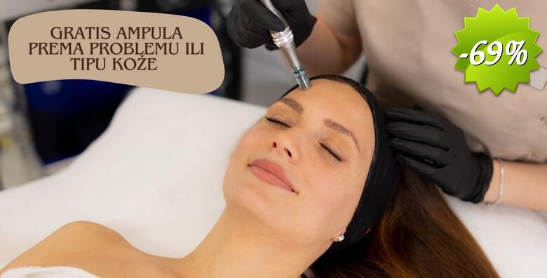 Microneedling uz njegu lica pilingom, maskom i masažom te ampula gratis prema problemu ili tipu kože u Glam Lab-u