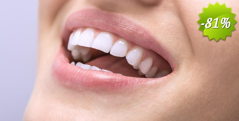 Čišćenje zubnog kamenca sa pjeskarenjem uz pregled u Dental studiju Marić