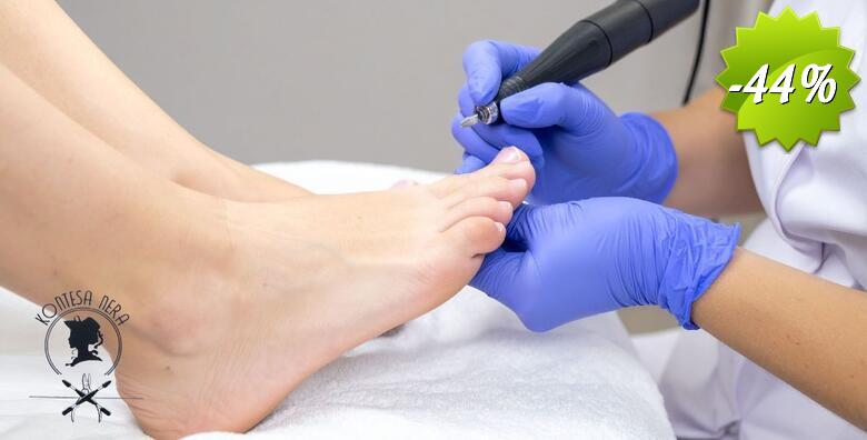 Zaslužena briga za vaša stopala - medicinska pedikura, obrada jednog kurjeg oka i masaža stopla u trajanju 10 minuta u Salonu Kontesa Nera