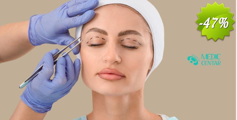 Blefaroplastika gornjih vjeđa - kirurški zahvat kojim se uklanja višak kože i masnog tkiva s gornjih kapaka u Sesvete Medic Centru